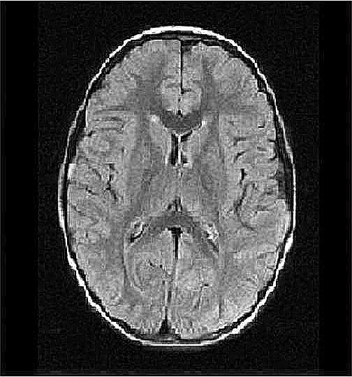 mri1070.jpg