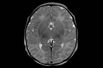 mri1024.jpg