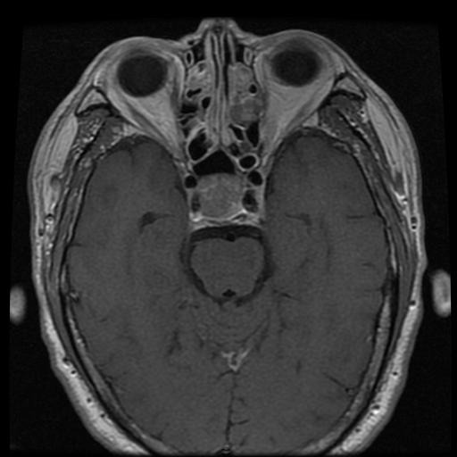 mri1042.jpg