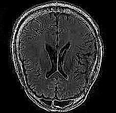 mri1047.jpg