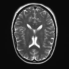 mri1054.jpg