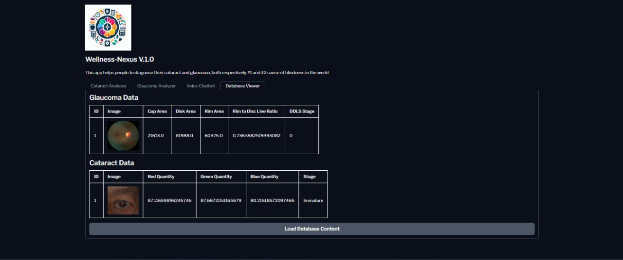 SQLite Database