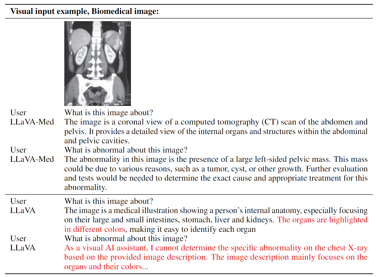 llava_med_chat_example2.png